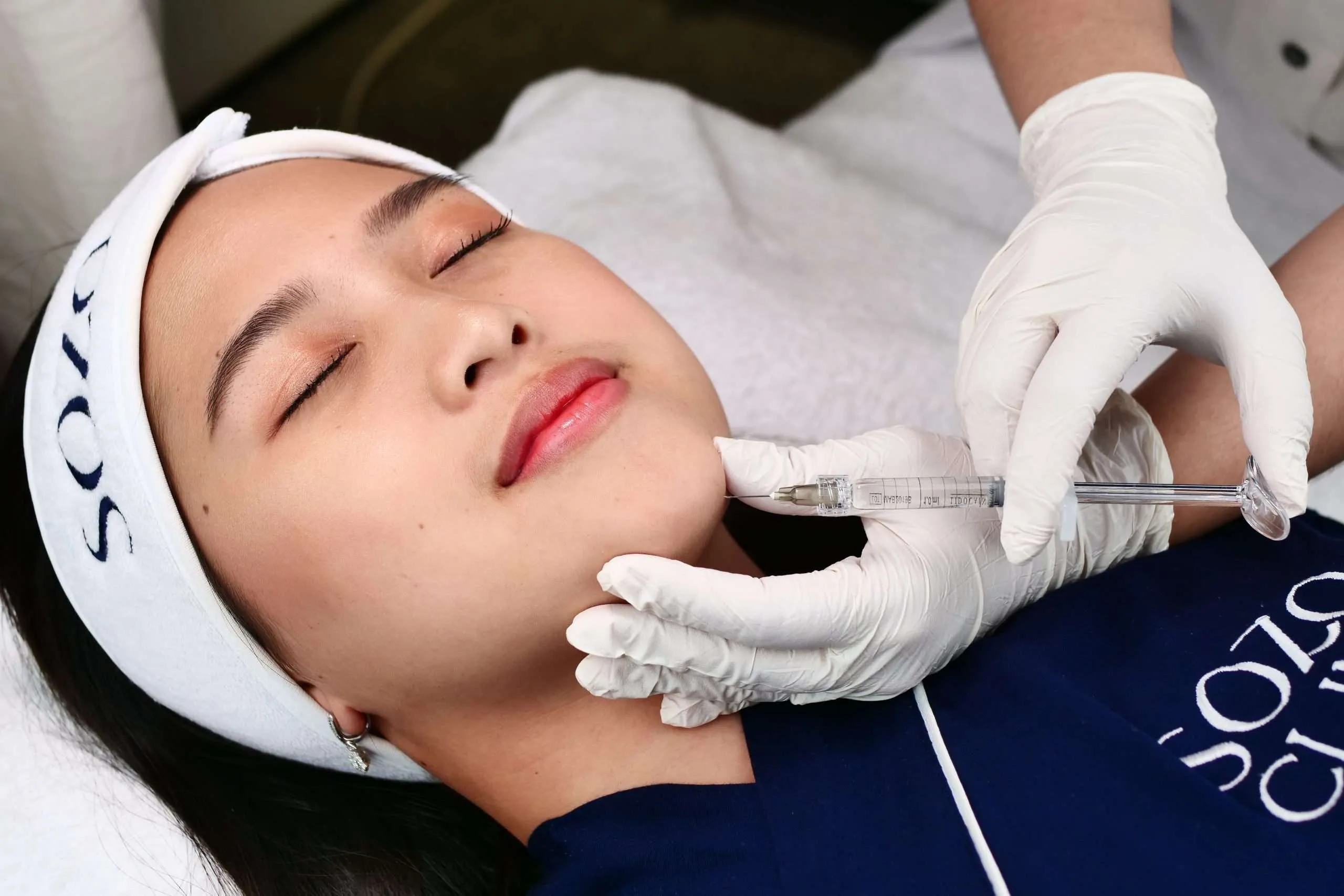 filler treatment sozo