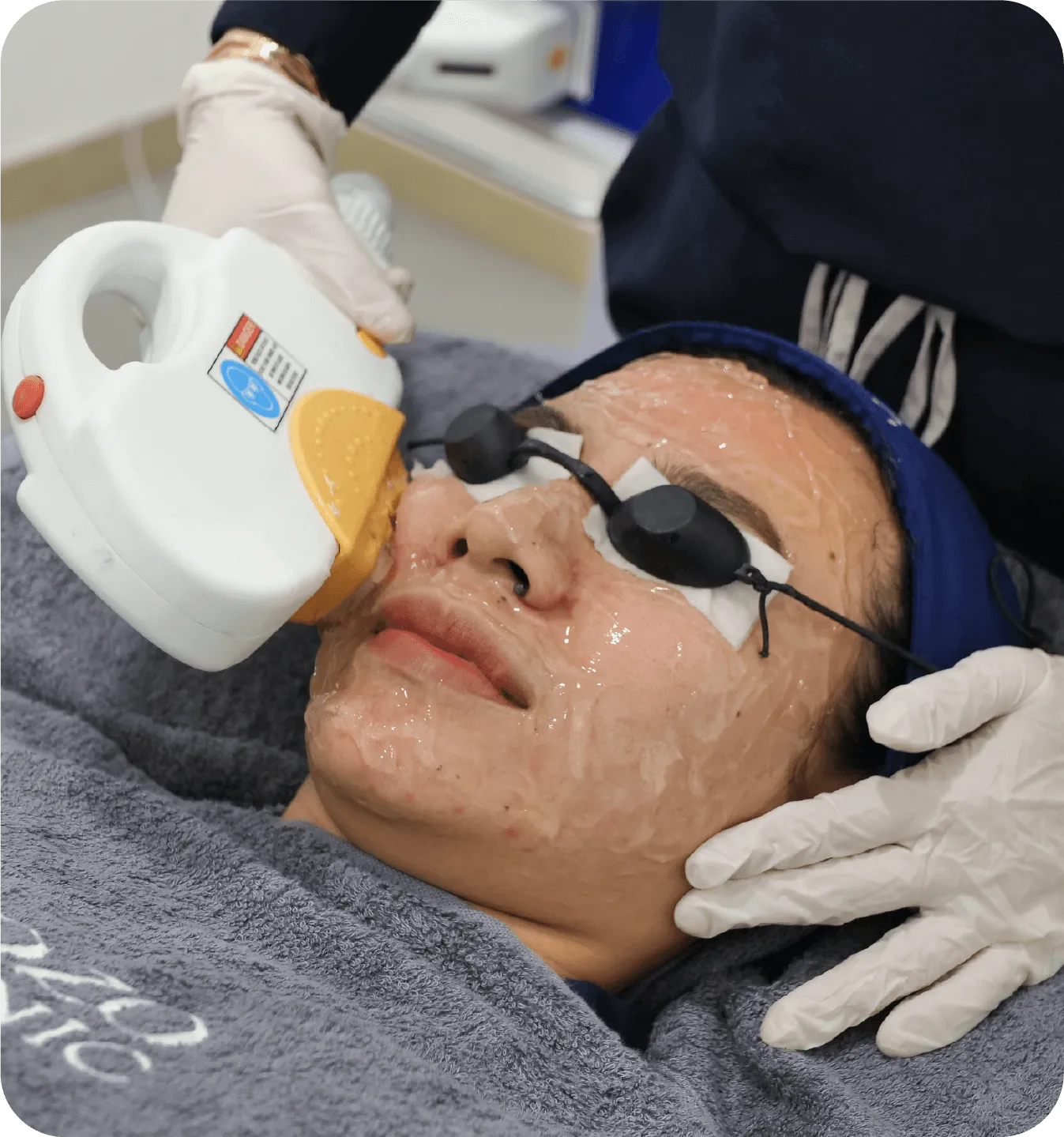 Apa Itu IPL Treatment