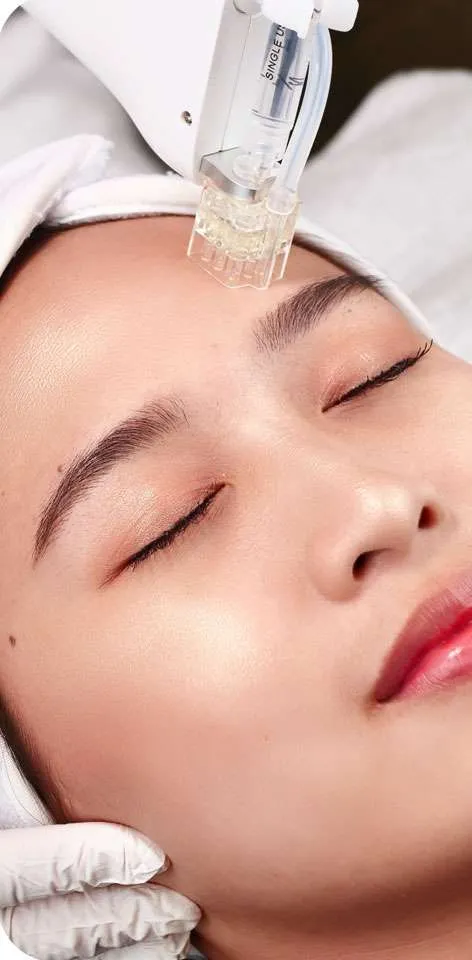 skin booster treatment - dna glow - sozo skin clinic