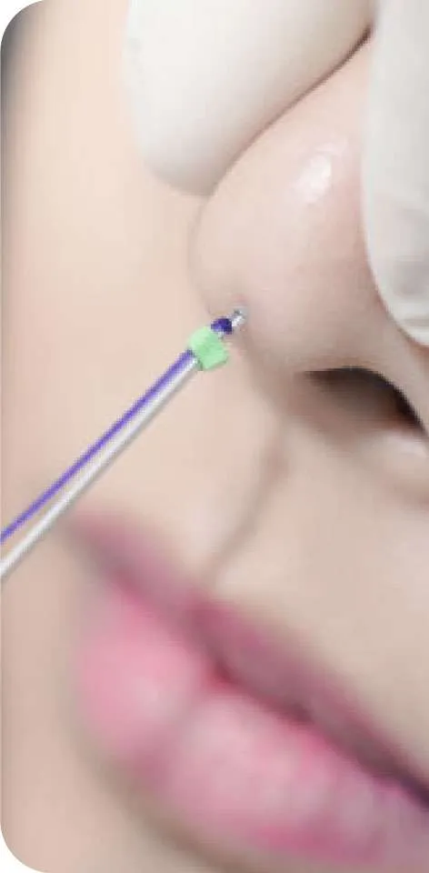 Nose Job Tanam Benang Hidung