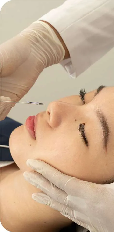 Perfect Nose Job Tanam Benang Hidung
