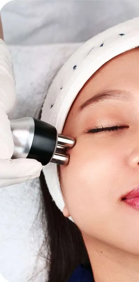Radiofrequency Treatment Sozo Skin Clinic