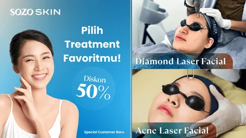 promo facial - diamond-laser dan acne laser - sozo skin clinic