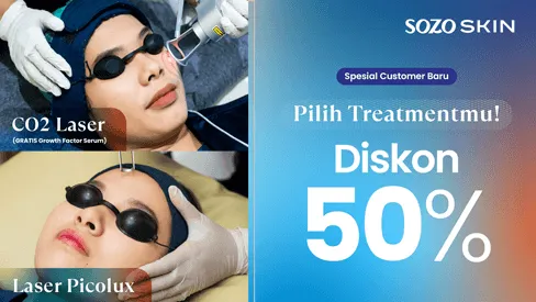 promo laser treatment - laser co2 dan picolux