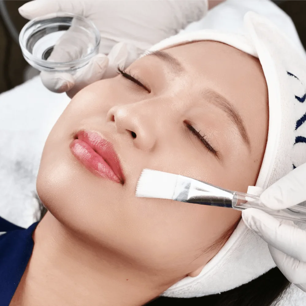 Derma Peel