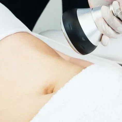 radiofrequency