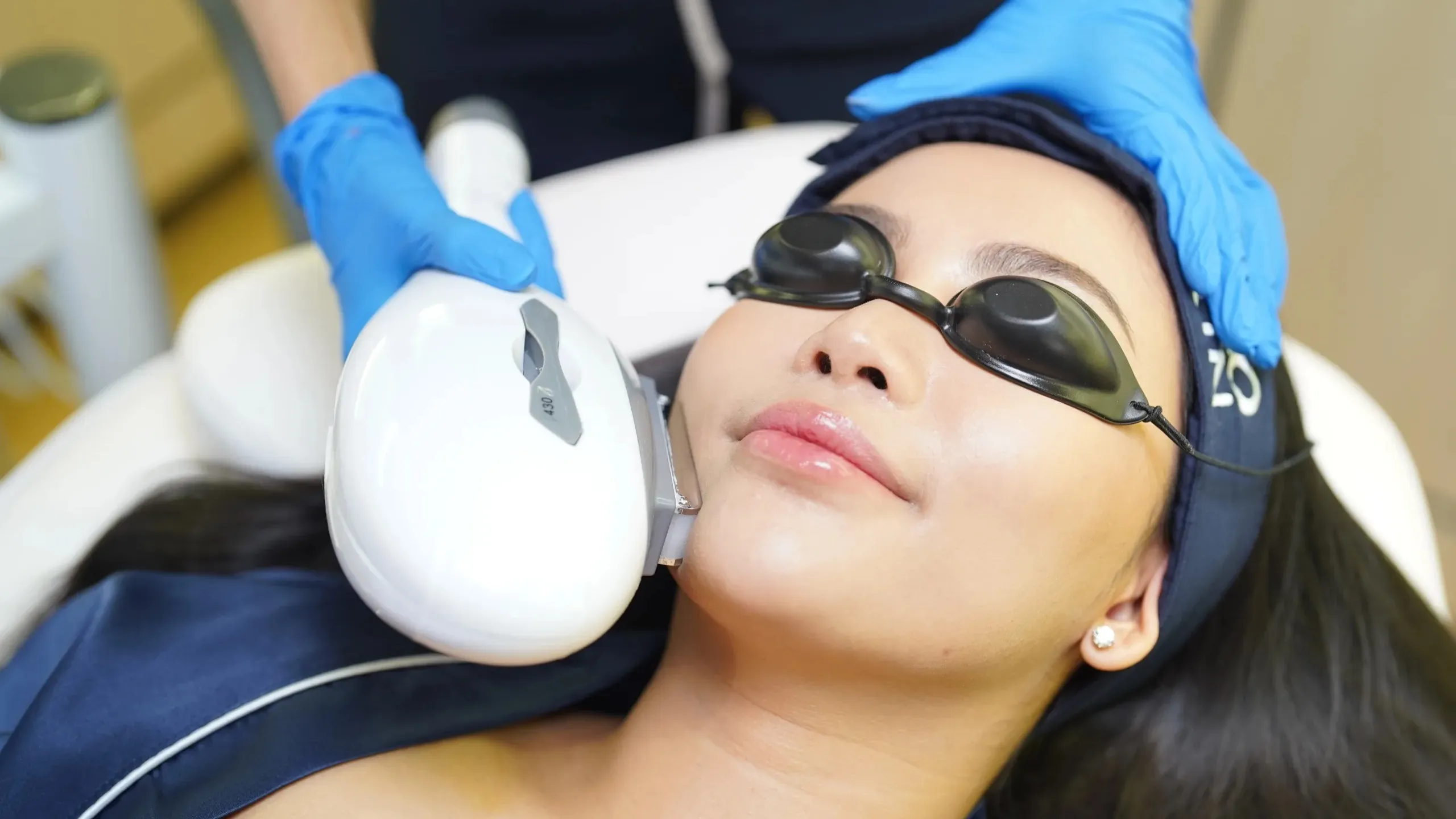 Hifu Treatment di Sozo Skin Clinic