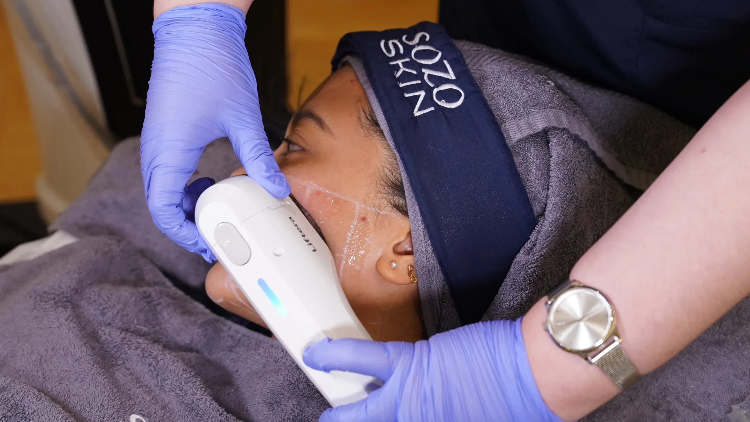 Hifu Treatment Sozo 2