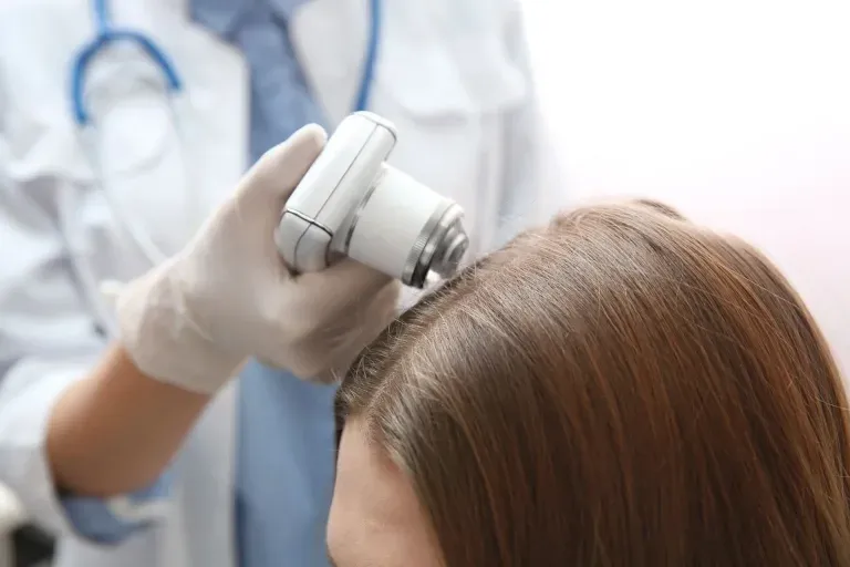 Rambut Rontok Parah? Ini Langkah Profesional untuk Mengatasinya