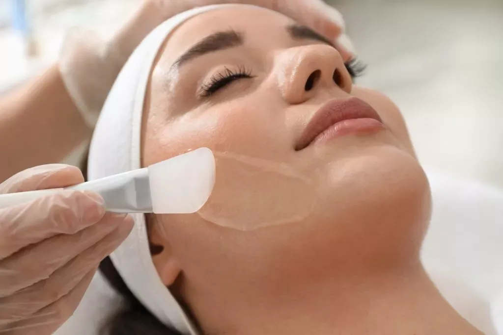 Coba Peeling Wajah Profesional di Sozo Clinic untuk Hasil Maksimal