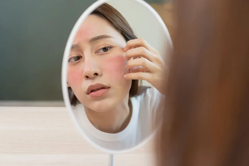 Bagaimana Cara Merawat Kulit Kering agar Selalu Lembap dan Tidak Kusam?