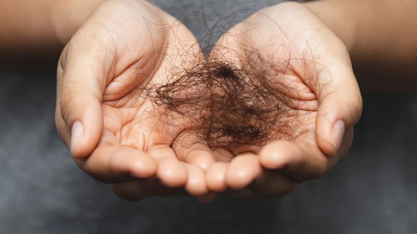 Untuk Kamu yang Punya Masalah Rambut Rontok Parah, Ini Solusinya