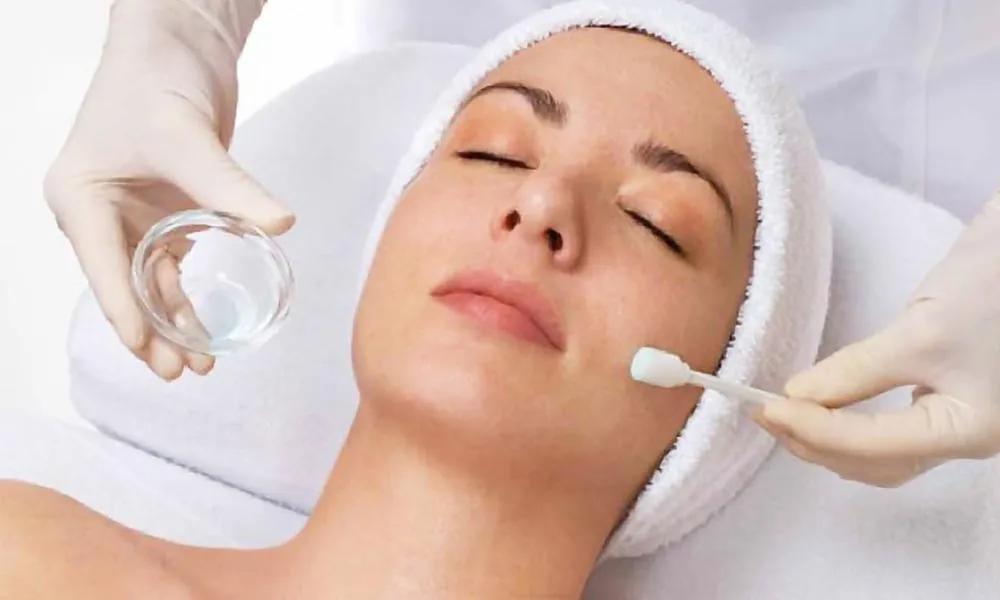 Bagaimana Chemical Peeling Bikin Wajah Glowing & Bebas Noda?