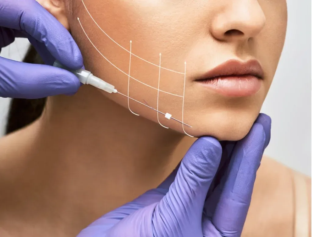 Face Lifting di 2025: Teknologi HIFU & Filler Menjadi Standar Baru