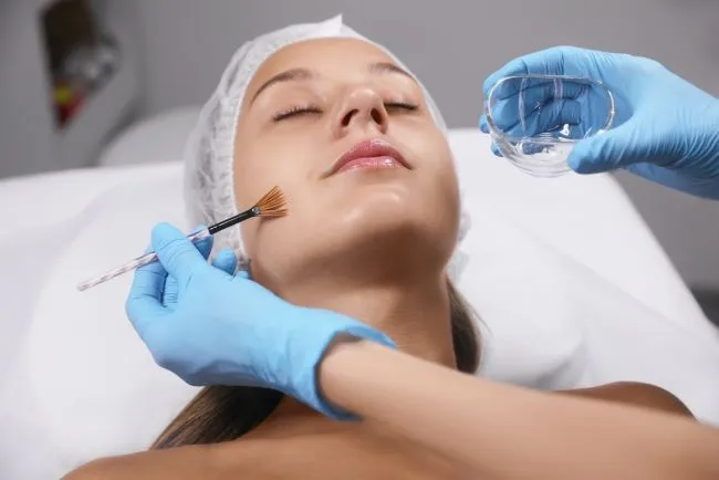 5 Manfaat Utama Peeling untuk Atasi Wajah Kusam & Bekas Jerawat 