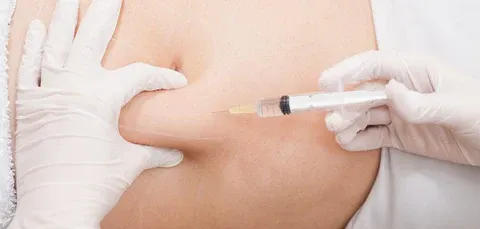 Suntik Kurus Tanpa Bedah? Ini Fakta yang Perlu Kamu Tahu!