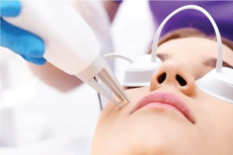 8 Pantangan Setelah Laser Wajah: Jangan Lakukan Ini Setelah Perawatan!