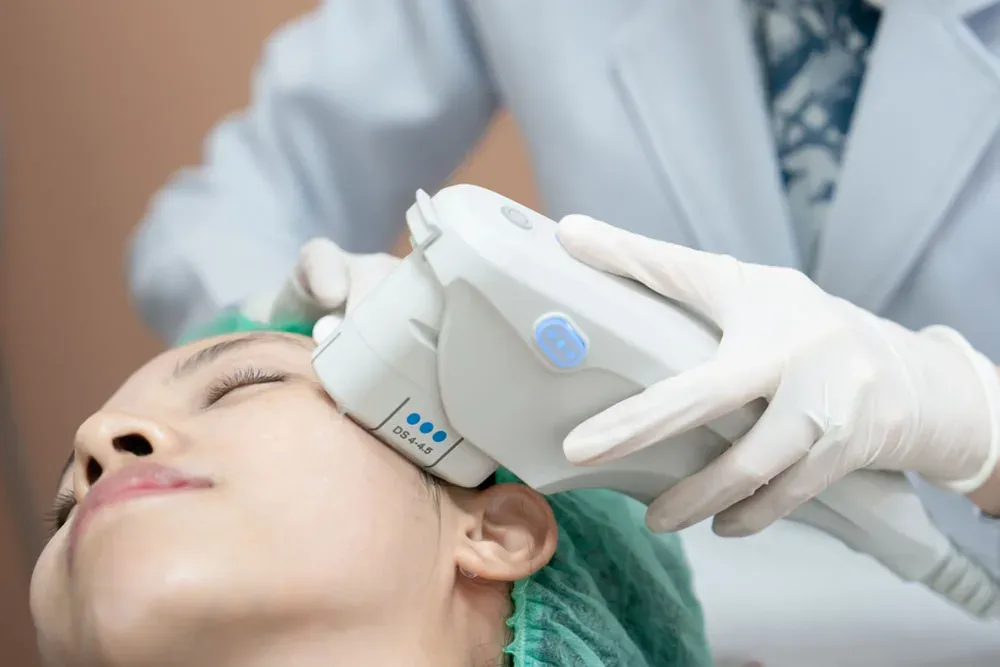 Apa Itu Ultherapy dan Perannya Dalam Lifting Wajah Tanpa Operasi