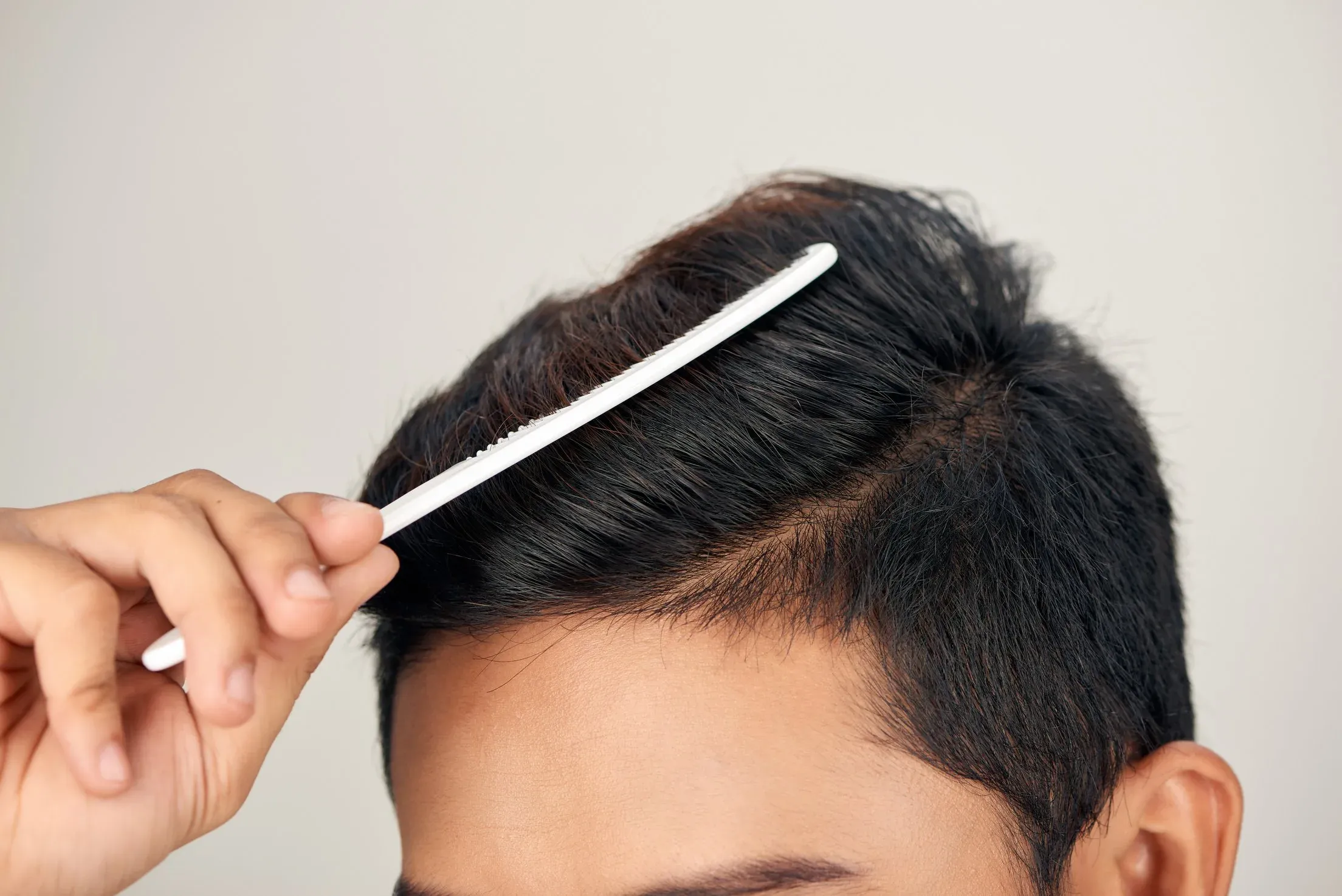 Mengapa Rambut Pria Mudah Kusut? Kenali Penyebab & Solusinya di Sini