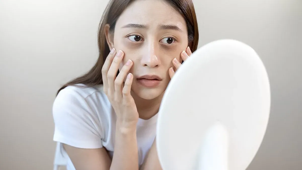 7 Cara Ampuh Atasi Kantung Mata Agar Wajah Kembali Segar