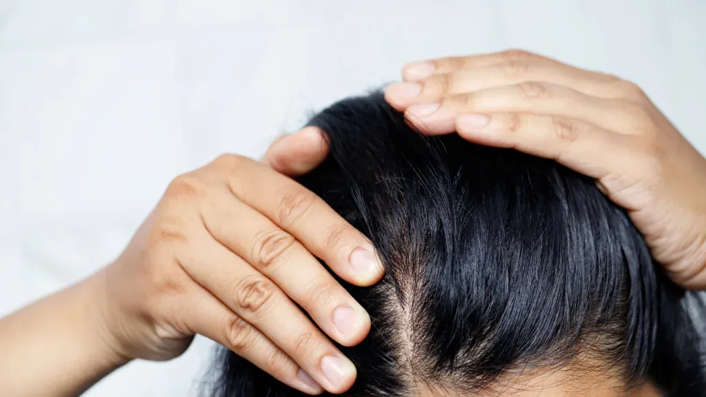 Bagaimana Cara Merangsang Hair Growth untuk Rambut Lebih Lebat?