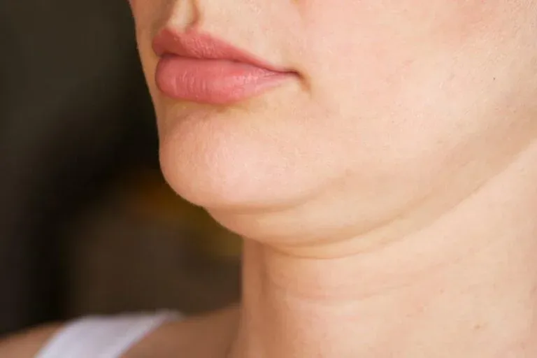 7 Cara Menghilangkan Double Chin Paling Ampuh untuk Wajah Tirus