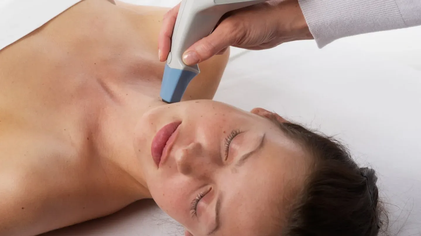 5 Manfaat Utama Exilis Treatment untuk Wajah Tirus & Tubuh Ideal