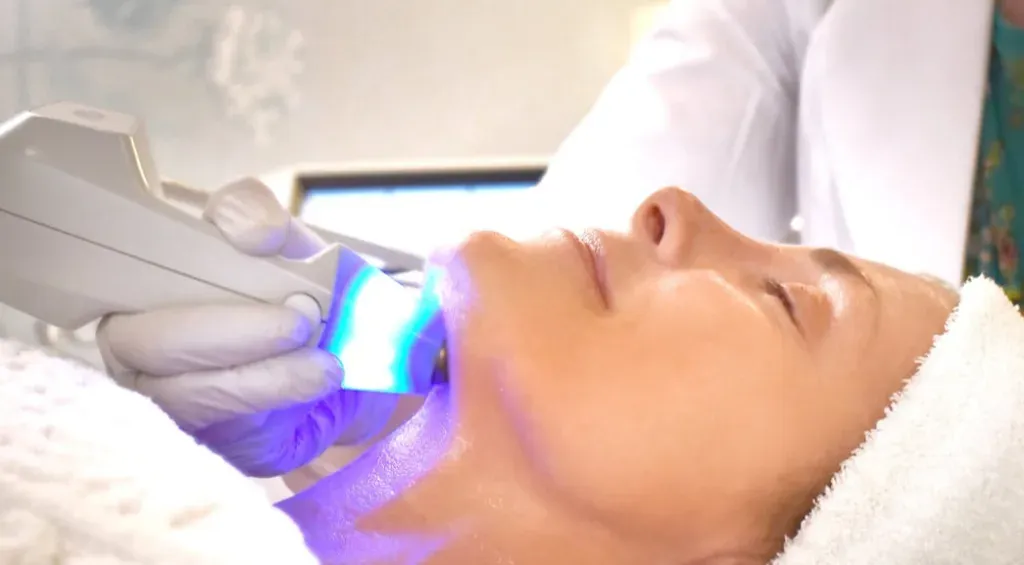 Exilis Ultra 360 Wajah: Solusi Kencangkan Kulit Tanpa Suntik