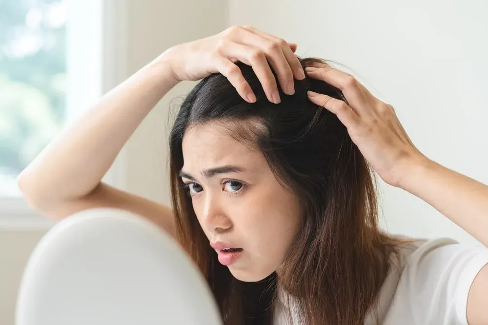 Solusi Androgenetic Alopecia di Sozo Skin Clinic: Hasil Terbukti Nyata