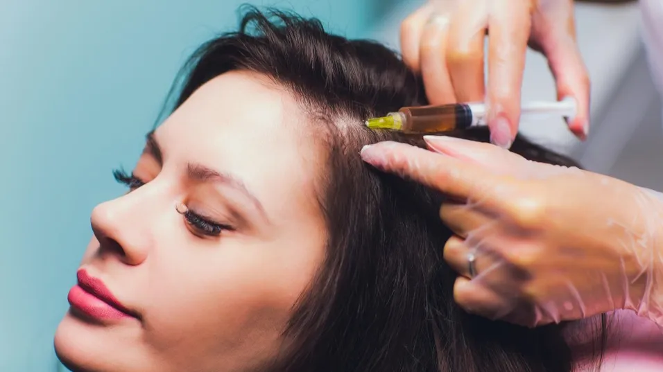 3 Jenis Perawatan Modern Hairfall: PRP, Laser, & Stem Cell, Apa Bedanya?