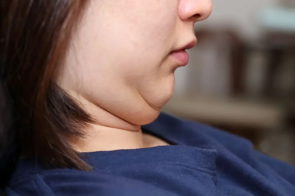 Tips Ampuh Hilangkan Lemak Leher di Rumah & Klinik Terdekat