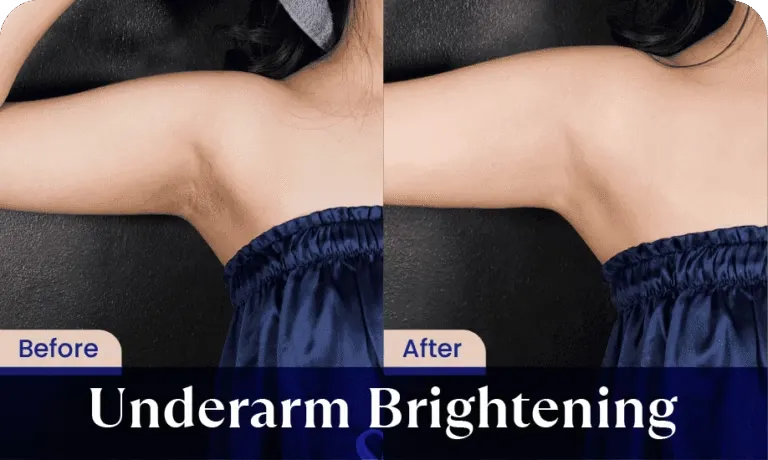 hasil-hair-removal-sozo