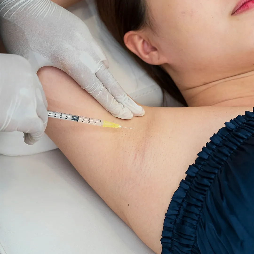 Botox Underarm Ketiak Treatment