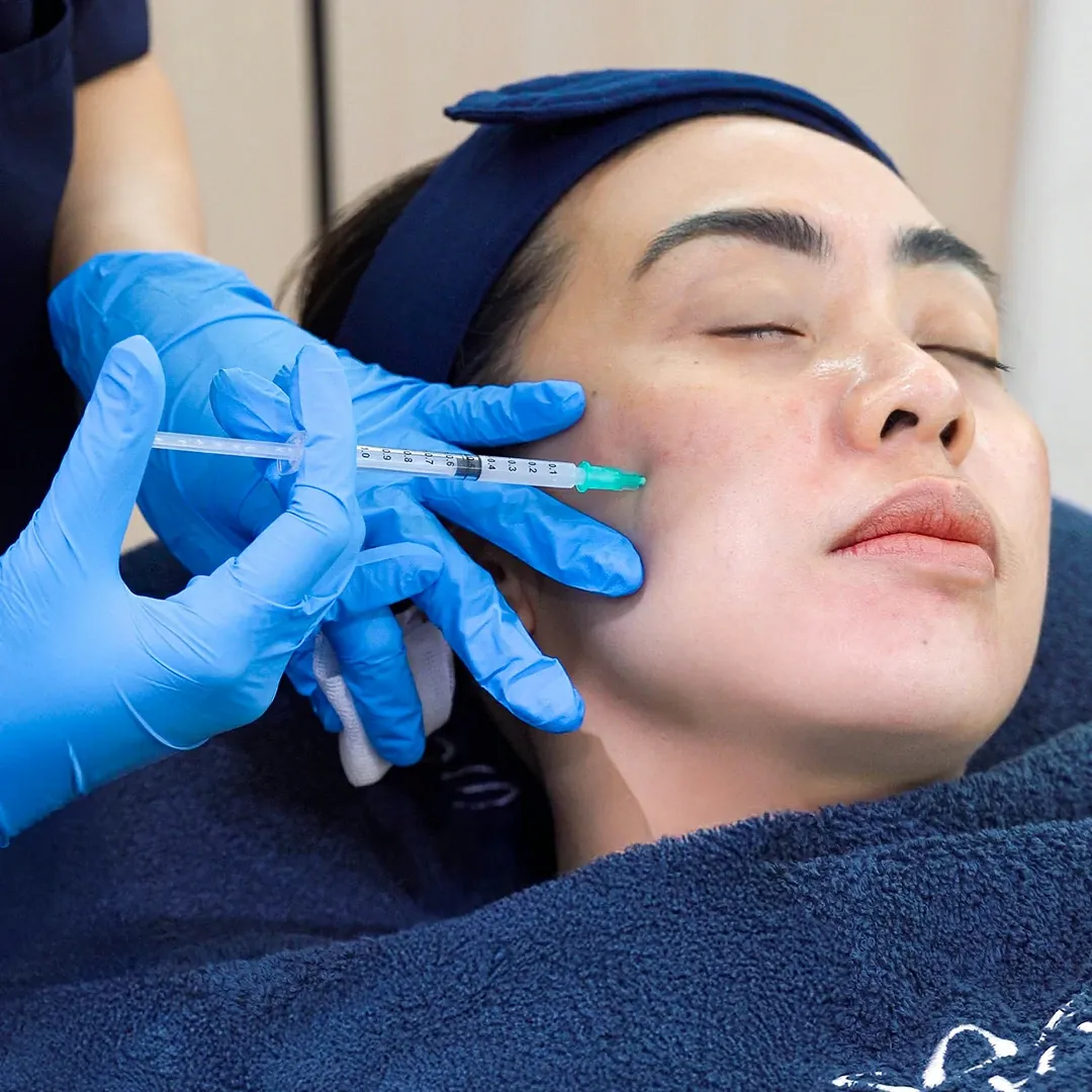 Juvelook Treatment Sozo Skin Clinic