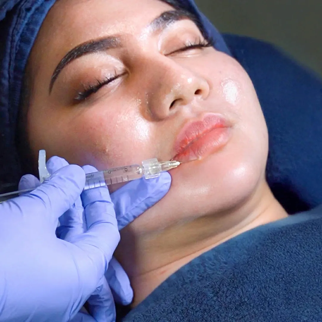 Korean Filler Treatment