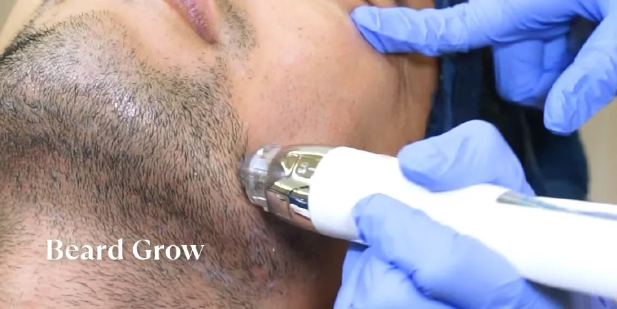 Laser Hair Removal Treatment Sozo Clinic