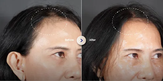 hasil hair treatment di sozo 1
