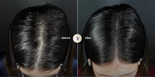hasil hair treatment di sozo 2