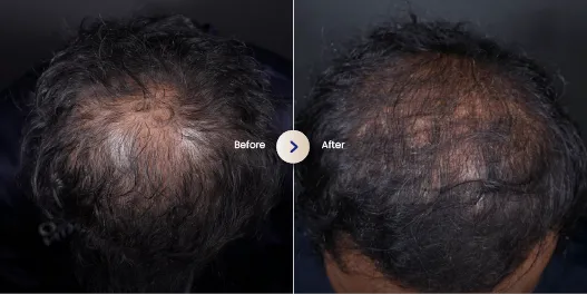 hasil hair treatment di sozo 3
