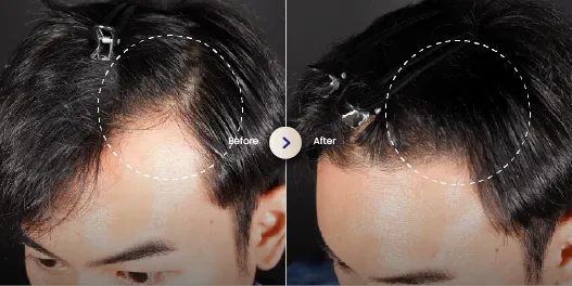 Landing Page Hair_Before After 4