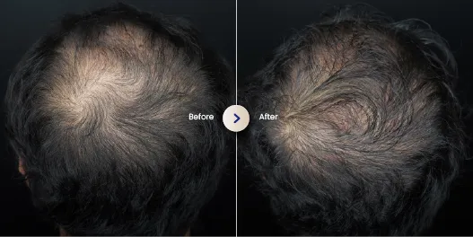 hasil hair treatment di sozo 4