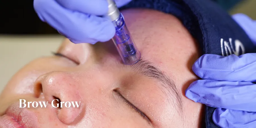 Brow Grow Treatment Sozo Skin Clinic