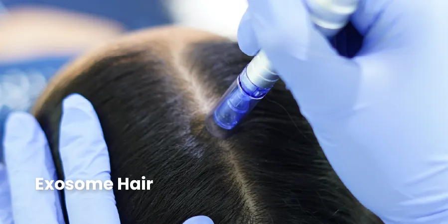 Exosome Hair 5cc