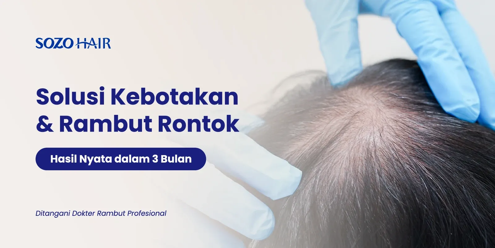 Promo Treatment Rambut SOZO Hair