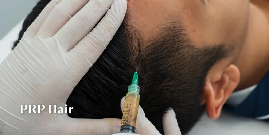 PRP Hair Treatment Sozo Clinic