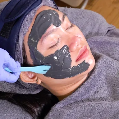 Acne Clear Facial Sozo Clinic
