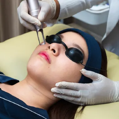 Acne Laser Facial Sozo Clinic