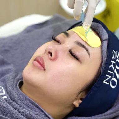Glow Peel