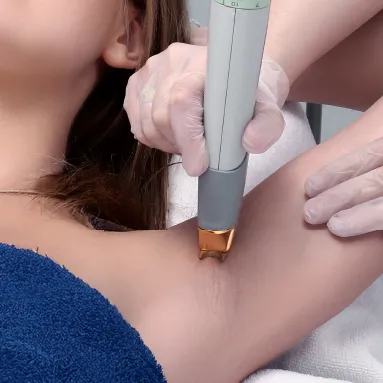 laser hair removal di sozo