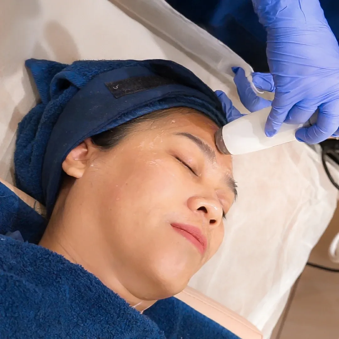 Liftera HIFU Sozo Skin Clinic